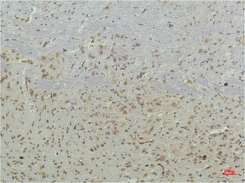 PPAR Delta (2F9) Mouse mAb Antibody