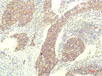 STAT1 (12E8) Mouse mAb
