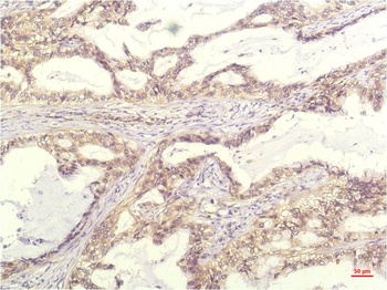 IL-8 (13F8) Mouse mAb Antibody