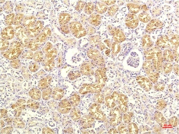 IL-8 (13F8) Mouse mAb Antibody