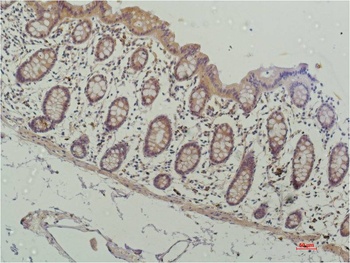 HDAC1 (4E1) Mouse mAb Antibody