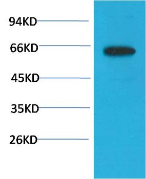 Phospho-Akt (S473) (6F8) Mouse mAb Antibody