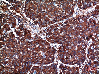 AKT (1H2) Mouse mAb Antibody