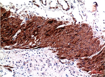 Muscle actin (3E9) Mouse mAb Antibody