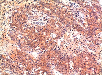 LC3A (5G10) Mouse mAb Antibody