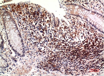 Epsilon Tubulin (3C1) Mouse mAb Antibody