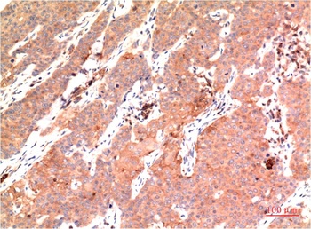 Epsilon Tubulin (3C1) Mouse mAb Antibody