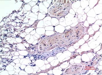 Smad3 (4C9) Mouse mAb Antibody