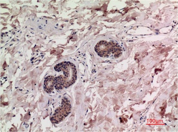 Smad3 (4C9) Mouse mAb Antibody