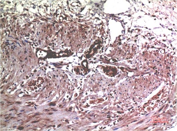 MMP2 (1H1) Mouse mAb Antibody