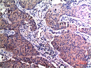 MMP2 (1H1) Mouse mAb Antibody