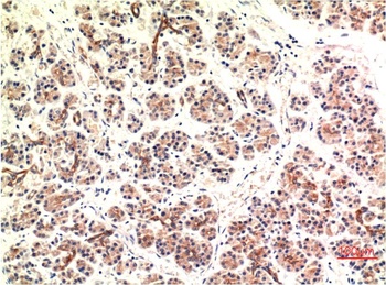 CHOP (2B1) Mouse mAb Antibody