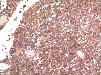 Tau (10E3) Mouse mAb Antibody