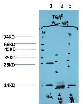 TGFβ1 (4B9) Mouse mAb