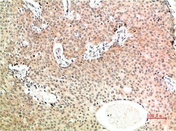 TGFβ1 (4B9) Mouse mAb
