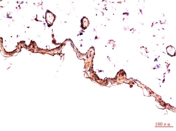 PDGFRα (5D1) Mouse mAb Antibody