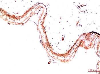 PDGFRα (5D1) Mouse mAb Antibody