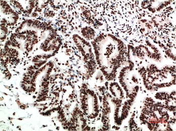 COX-2 (2G1) Mouse mAb Antibody