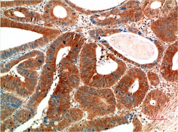 Phospho-ERK 1/2 (Y205/222) (7A6) Mouse mAb Antibody