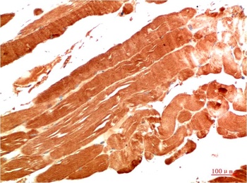 NBR1 (7C3) Mouse mAb Antibody