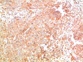 ATG7 (3D6) Mouse mAb Antibody