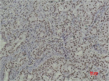 Histone H3 (tri methyl K79) Monoclonal antibody