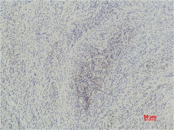 Histone H3(mono methyl K79) Monoclonal antibody