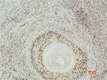 Histone H3(di methyl K27) Monoclonal antibody