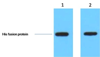 His-Tag Rabbit pAb Antibody