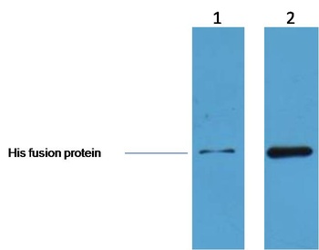 His-Tag Rabbit pAb Antibody
