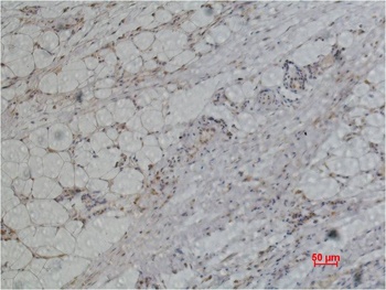 PRDX1 Rabbit pAb Antibody