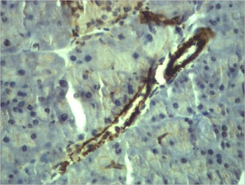 α-Smooth Muscle Actin Rabbit pAb Antibody