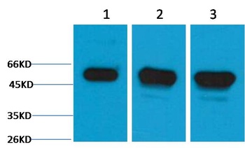 β III Tubulin Rabbit pAb Antibody