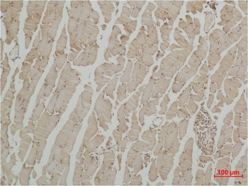 β III Tubulin Rabbit pAb Antibody