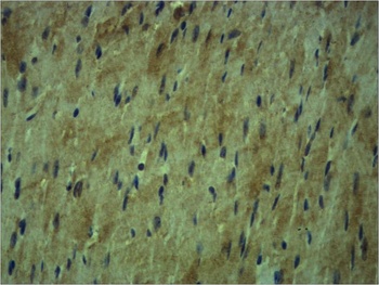 β Tubulin Rabbit pAb Antibody