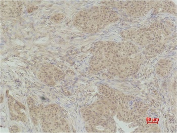 Histone H3(Phospho Thr32 ) Rabbit pAb Antibody