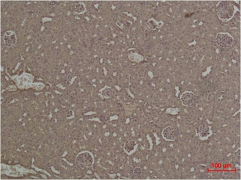 HIF-1α Rabbit pAb Antibody