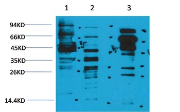 Acetyl Lysine Rabbit pAb Antibody