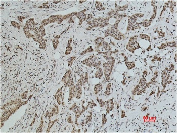 Acetyl Lysine Rabbit pAb Antibody