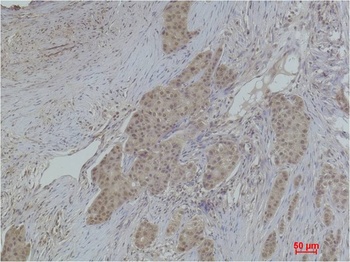 Histone H2A.X(Acetyl Lys5) Rabbit pAb Antibody