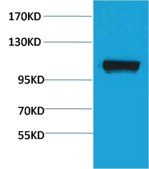 PEPC Rabbit pAb Antibody