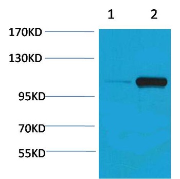 PEPC(Phospho Ser15) Rabbit pAb Antibody
