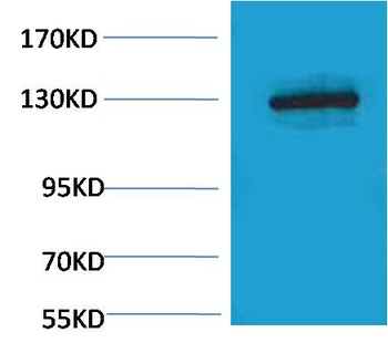 E-Cadherin Rabbit pAb Antibody