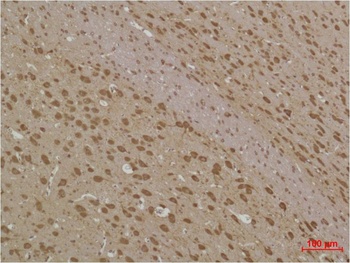 LC3B Rabbit pAb Antibody