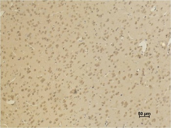 AMPA Receptor 4（GluA4) Rabbit pAb Antibody