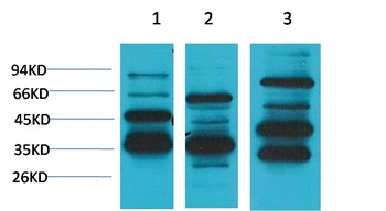 Angiotensin(1-7) Mas Receptor Rabbit pAb Antibody