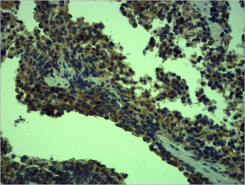 TLR4 Rabbit pAb Antibody