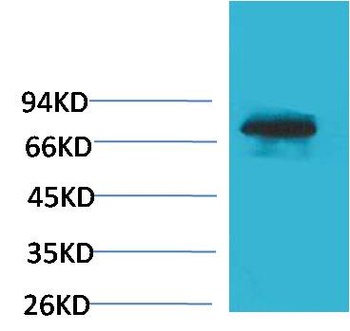 Transferrin Rabbit pAb Antibody