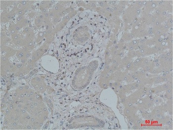 Transferrin Rabbit pAb Antibody