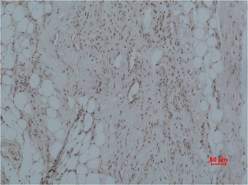CALHM1 Rabbit pAb Antibody